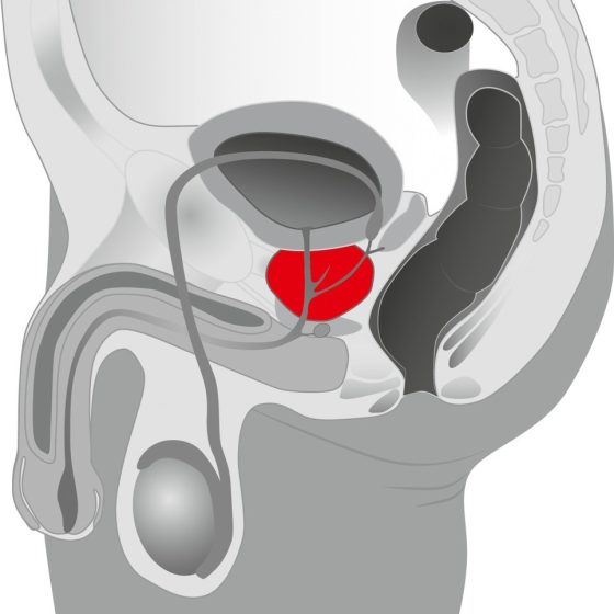 Tentacular Tease prosztata masszírozó vibrátor